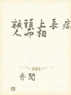 额头上长痣的女人面相