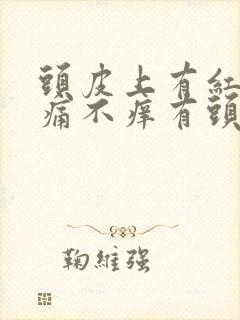 头皮上有红斑不痛不痒有头皮屑