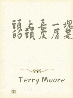 头上长一块一块的头皮屑是怎么回事