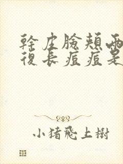 干皮脸颊两边反复长痘痘是什么原因引起的