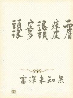 头皮很痒而且有很多头皮屑怎么办