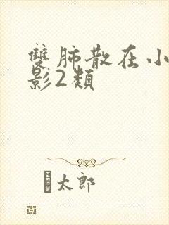 双肺散在小结节影2类