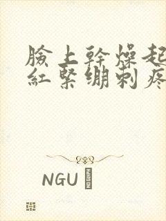 脸上干燥起皮发红紧绷刺疼如何治疗