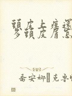 头皮上痒还有好多头皮屑怎么办