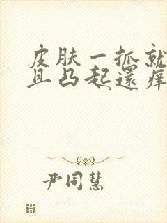 皮肤一抓就红而且凸起还痒怎么办封面