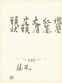 头皮大红块和块状头屑怎么治