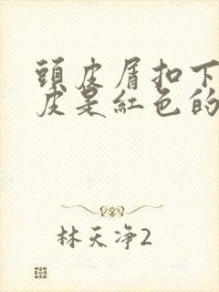 头皮屑扣下来头皮是红色的