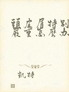 头皮屑特别头痒严重怎么办