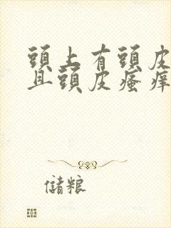 头上有头皮屑而且头皮瘙痒怎么办