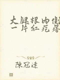 大腿根内侧起了一片红疙瘩很痒