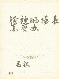 脸被晒伤长痘痒怎么办封面