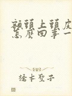 额头上头皮疼是怎么回事一按就会疼