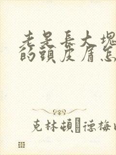 老是长大块大块的头皮屑怎么办