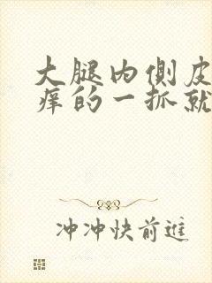 大腿内侧皮肤痒痒的一抓就更痒然后起疙瘩