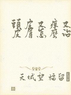 头皮又痒又有头皮屑怎么治