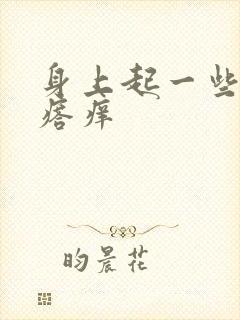 身上起一些红疙瘩痒