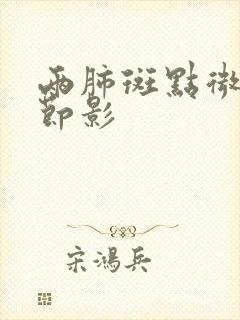 两肺斑点微小结节影