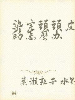 染完头头皮痒痒的怎么办