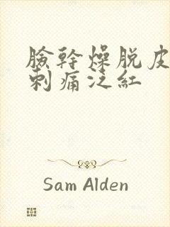 脸干燥脱皮紧绷刺痛泛红