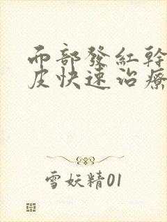 面部发红干燥脱皮快速治疗方法