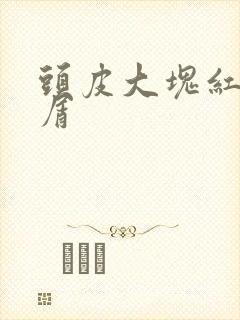 头皮大块红斑脱屑