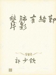 双肺有结节影斑片影封面