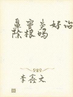 鼻窦炎好治吗能除根吗