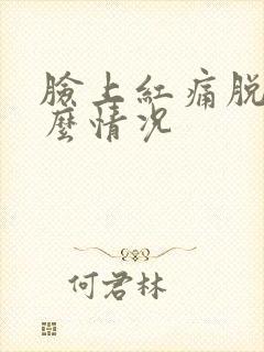 脸上红痛脱皮什么情况封面