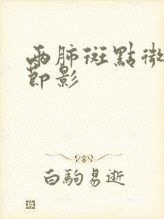 两肺斑点微小结节影