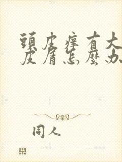 头皮痒有大量头皮屑怎么办