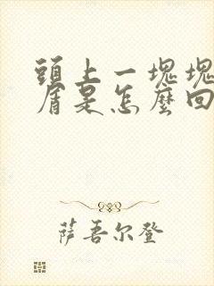 头上一块块头皮屑是怎么回事