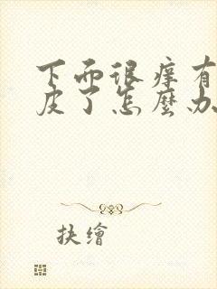 下面很痒有点破皮了怎么办