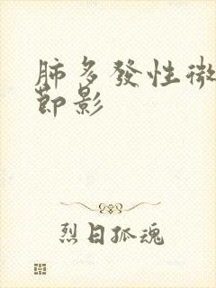 肺多发性微小结节影