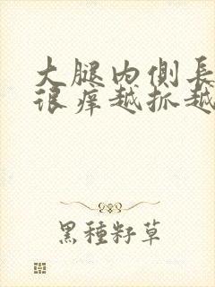 大腿内侧长疙瘩很痒越抓越多