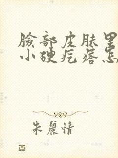 脸部皮肤里边有小硬疙瘩怎么回事