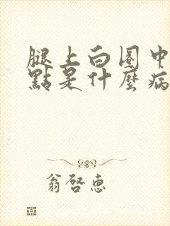 腿上白圈中间红点是什么病