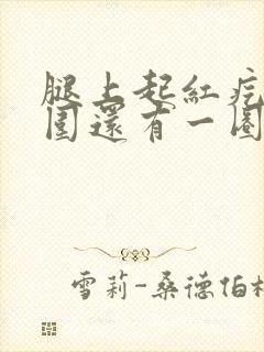 腿上起红疙瘩周围还有一圈白色的