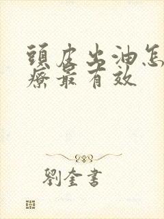 头皮出油怎么治疗最有效