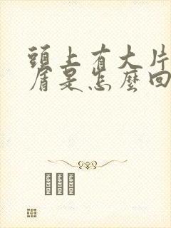 头上有大片头皮屑是怎么回事