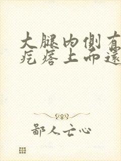 大腿内侧有红色疙瘩上面还有水泡