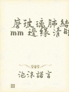 磨玻璃肺结节5mm 边缘清晰封面