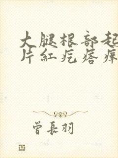 大腿根部起了一片红疙瘩痒封面