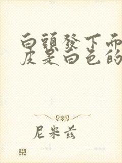 白头发下面的头皮是白色的是什么原因