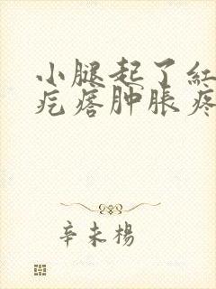 小腿起了红色硬疙瘩肿胀疼