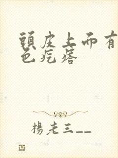 头皮上面有小红色疙瘩封面