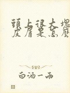 头上很大块的头皮屑是怎么回事