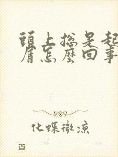 头上总是起头皮屑怎么回事