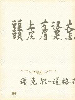 头上有很大块的头皮屑是怎么回事