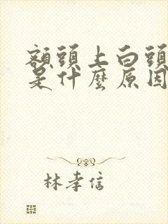 额头上白头发多是什么原因