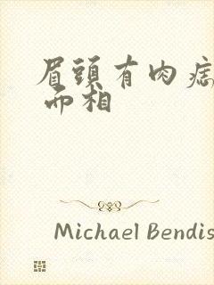 眉头有肉痣凸起 面相